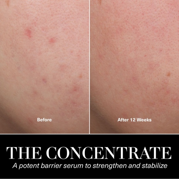 La Mer The Concentrate - 0.17 oz mini - Picture 2 of 5